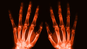hands_xray-image xray-image_hands