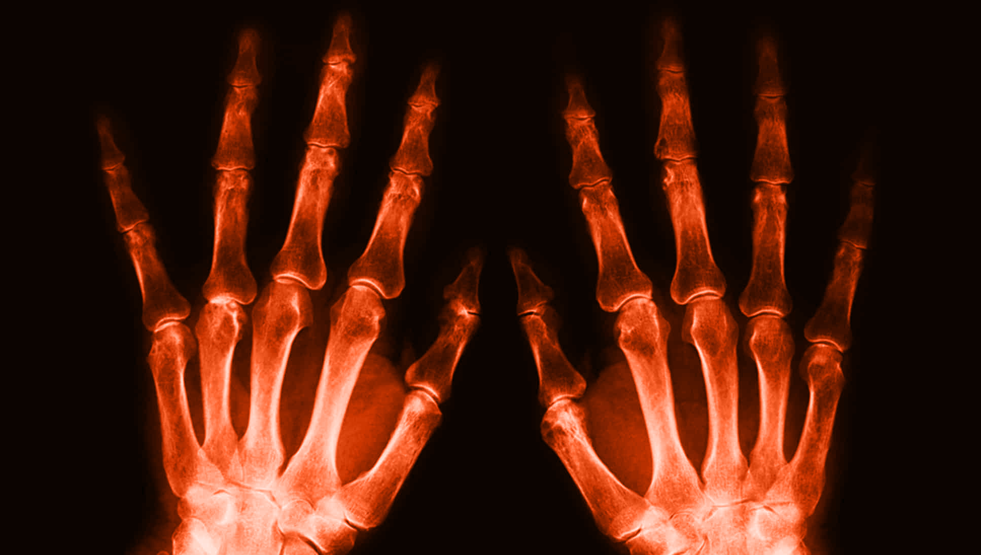 hands_xray-image xray-image_hands